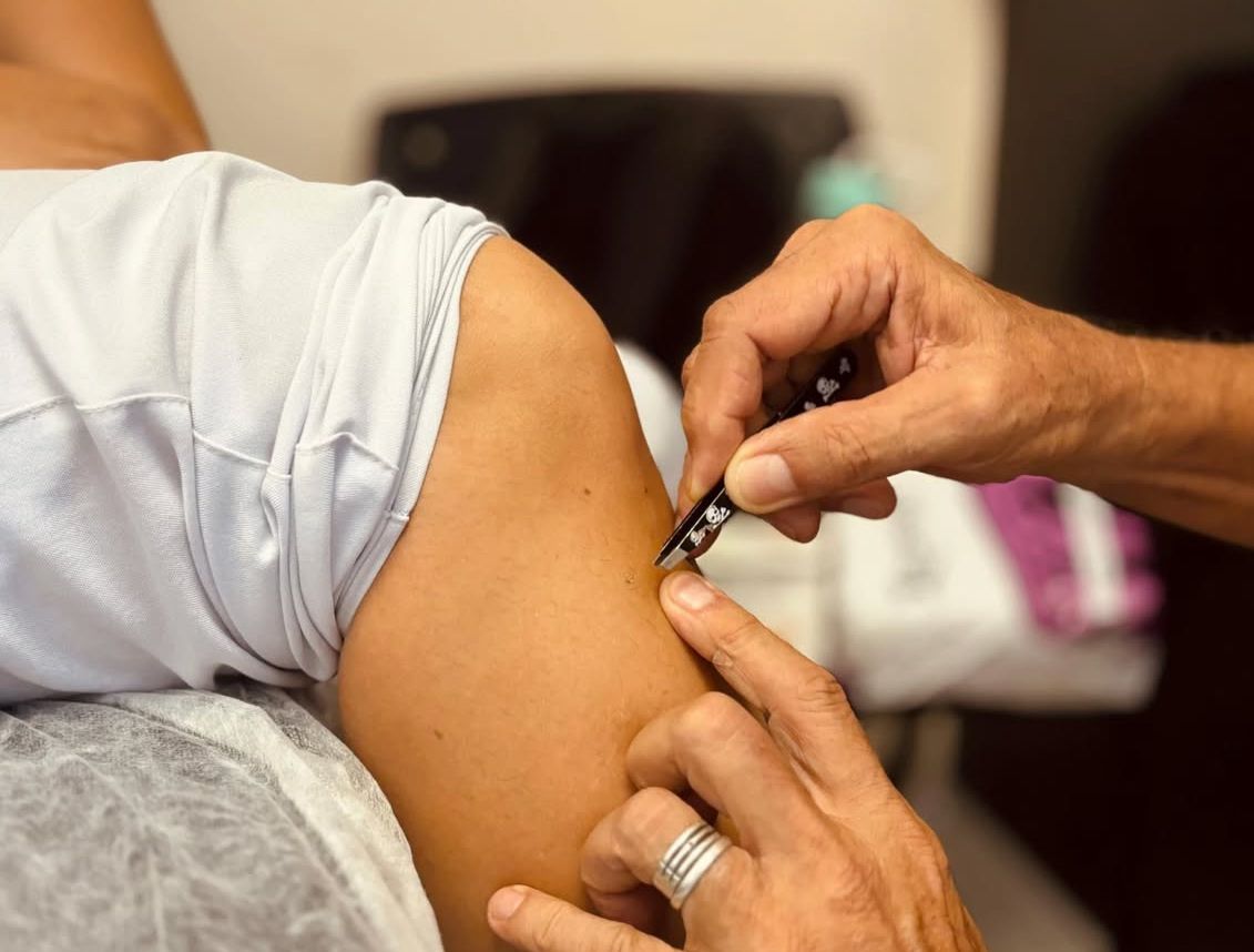 Janeiro Branco: Hospital de Arraial realiza sessões de acupuntura para colaboradores