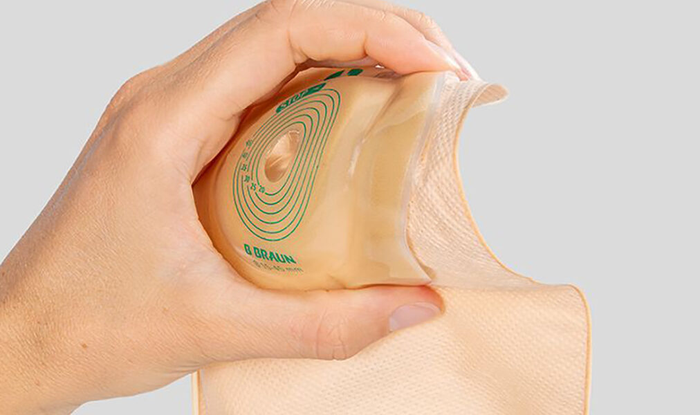 Cabo Frio organiza encontro regional para orientar pacientes estomizados