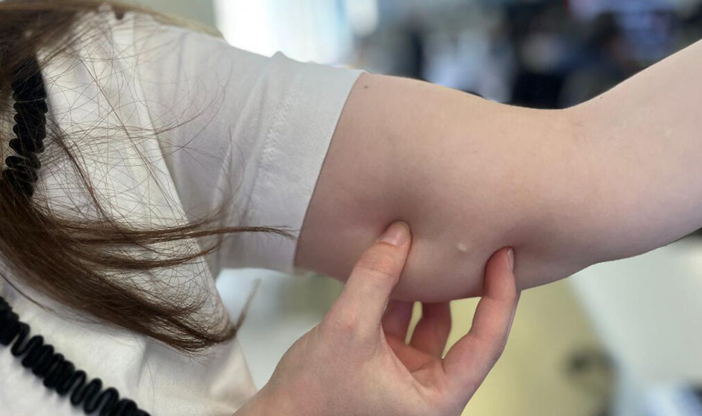 Cabo Frio amplia acesso a contraceptivos com implantação de DIU em unidades da Atenção Básica