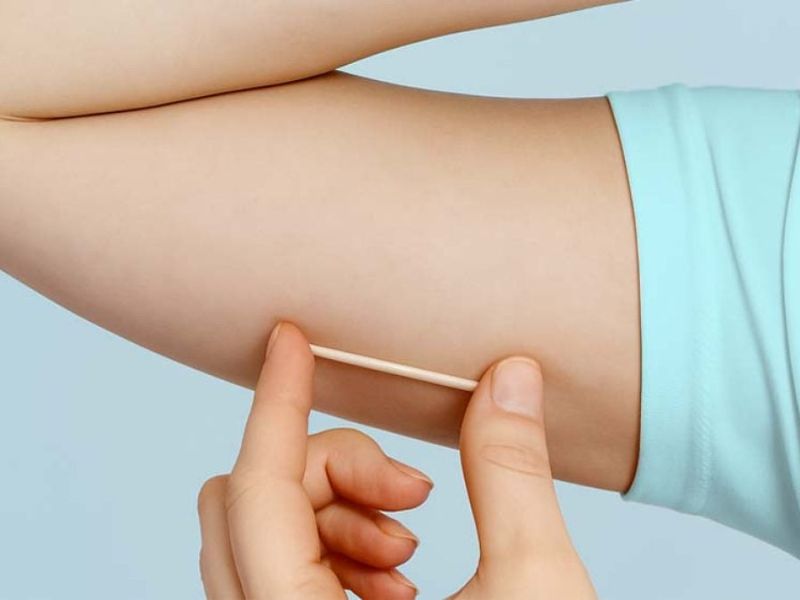 Secretaria de Saúde de Saquarema disponibiliza novo método contraceptivo para mulheres